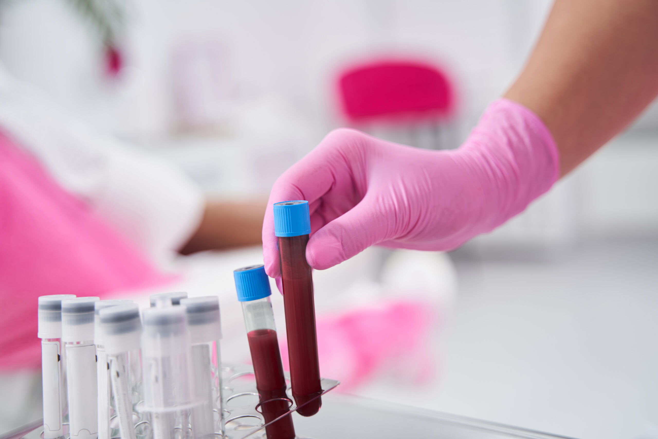 Hematología